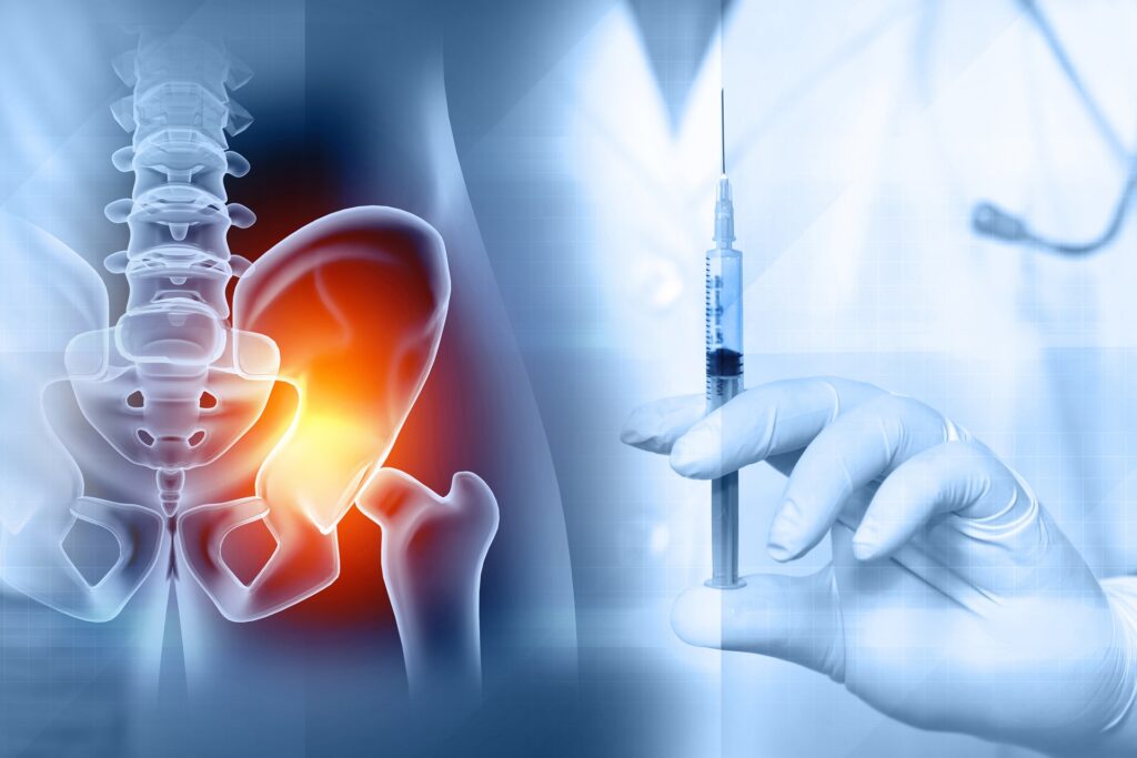 A Doctor holding Injection and near hip arthritis model | Injection for hip arthritis | Hudson Premier PT & Sports in Union City, Jersey City, NJ