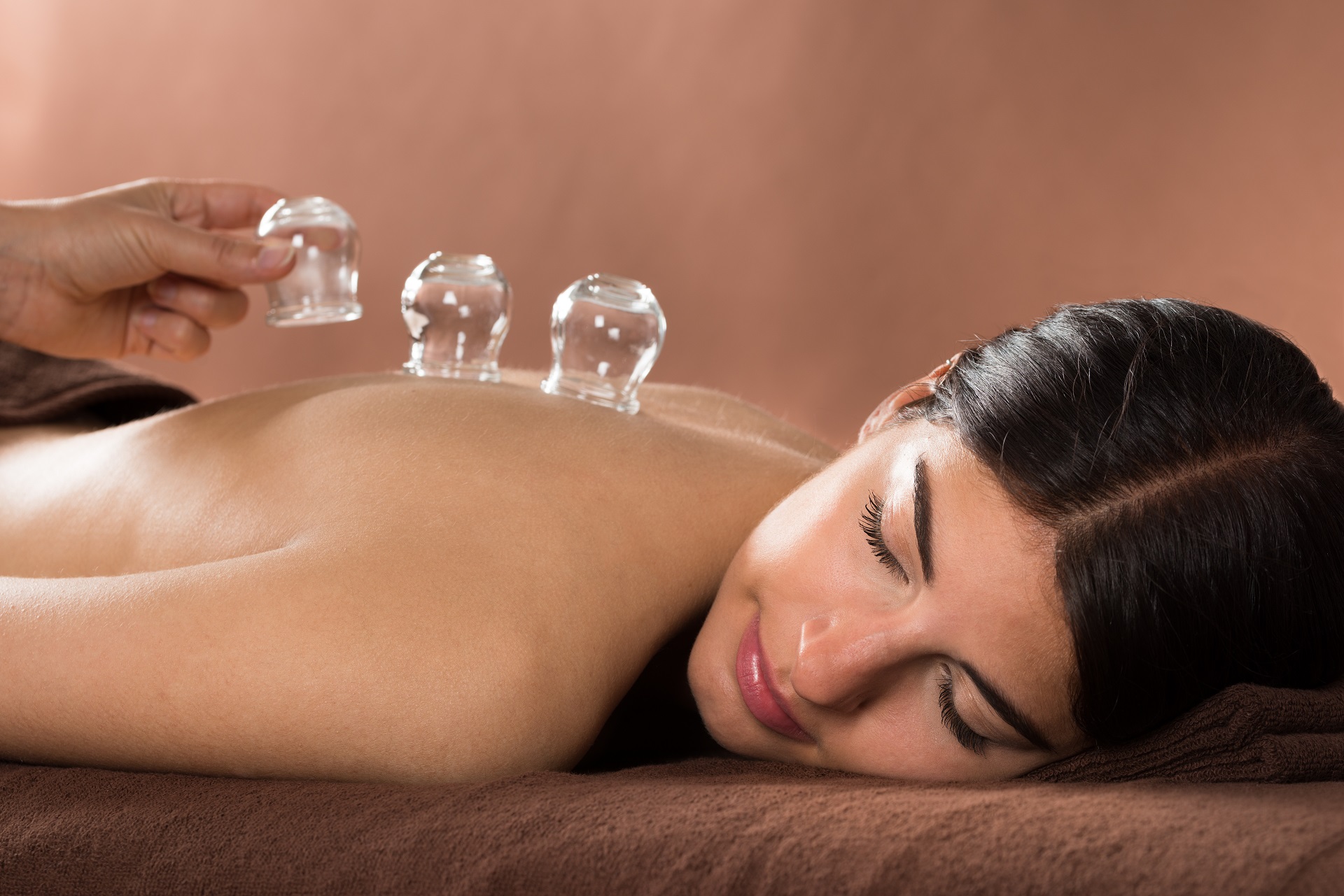 Woman Lying On Front Receiving Cupping Treatment On Back | Hudson Premier PT & Sports in Union City, Jersey City, NJ